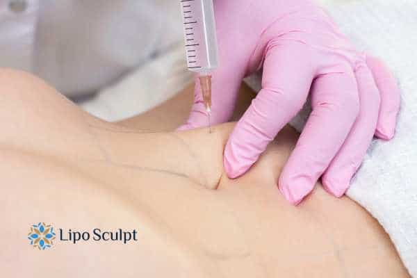 Aqualyx for Muffin Tops: What to Know Before Fat-Dissolving Injections 4 Are there risks Biggleswade?