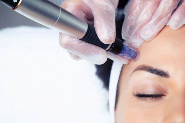 Explaining Total Skin Tightening Treatment and What to Expect 2 What Skin Concerns Can Total Skin Tightening Treatment Help With Biggleswade?