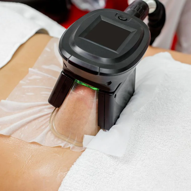 Fat Freezing treatment Biggleswade
